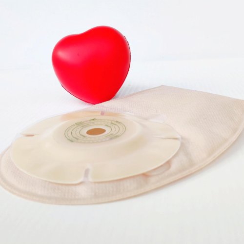 Zarastanie stomii czy da się go uniknąć?