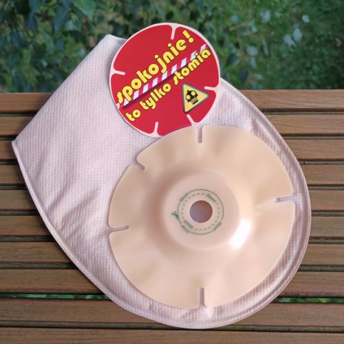 (Nad)aktywna stomia? Kiedy występuje