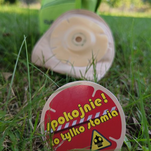 Wynicowanie stomii, co to?